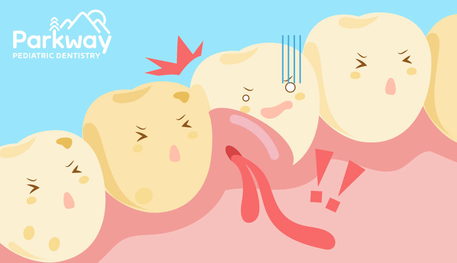 Bleeding Gums