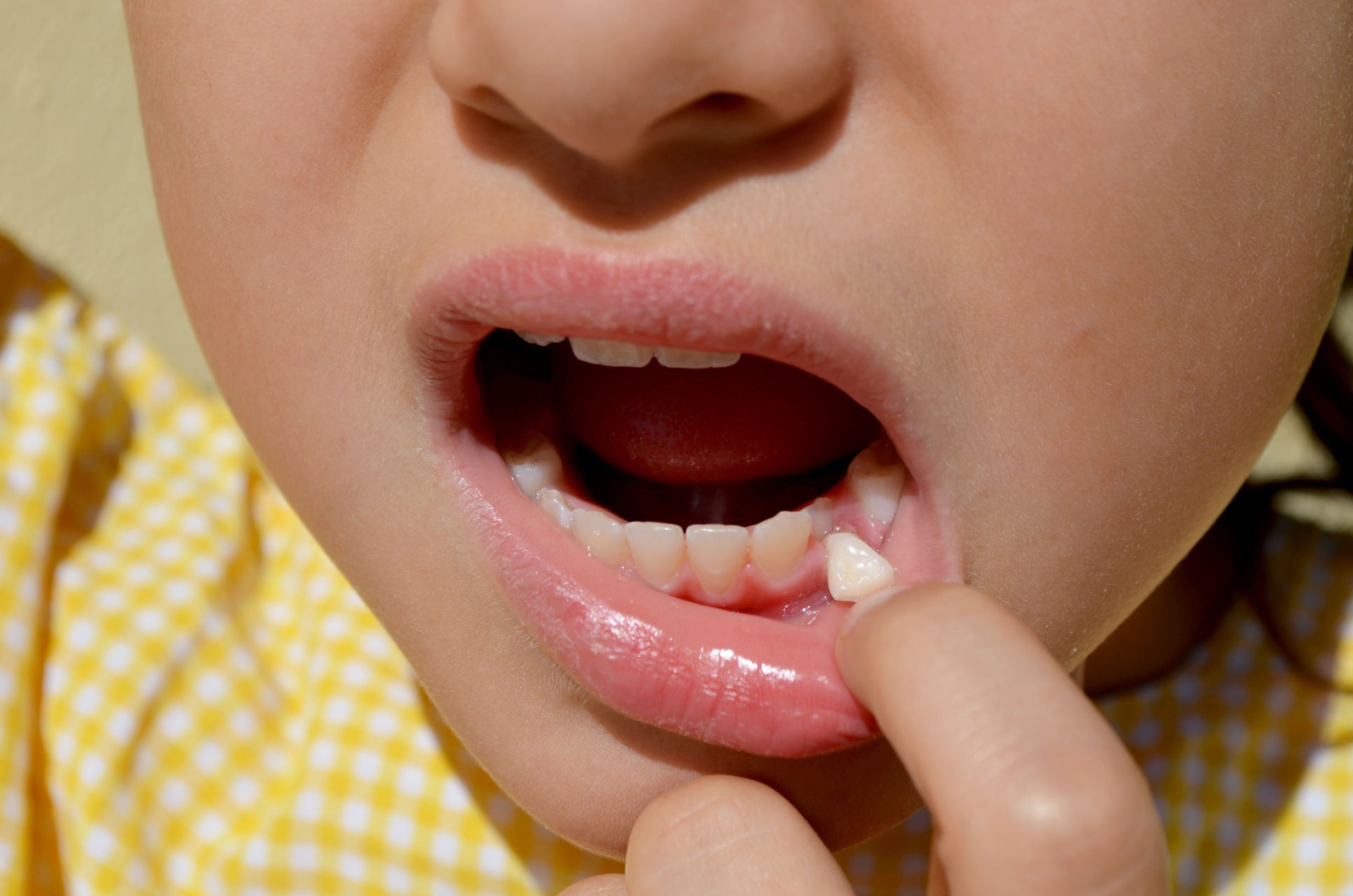 pediatric dentist in Roanoke, VA